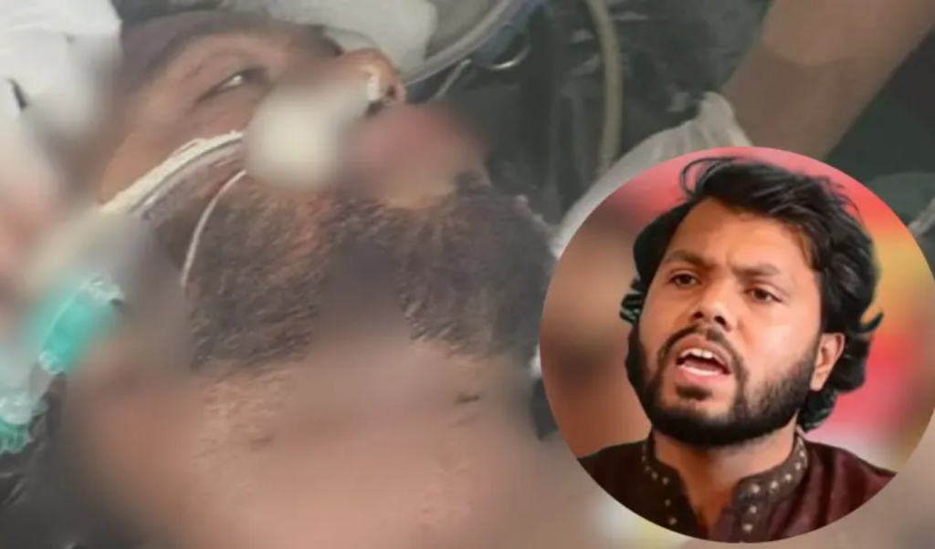 অস্ত্রোপচারে ব্যাপক রক্তক্ষরণ হয়ঃ নিউরোসার্জারি বিভাগের প্রধান ডা. জাহিদ হাসান 1765552524 অস্ত্রোপচারের সময় ব্যাপক রক্তক্ষরণ হয় : নিউরোসার্জারি প্রধান ডা. জাহিদ হাসান