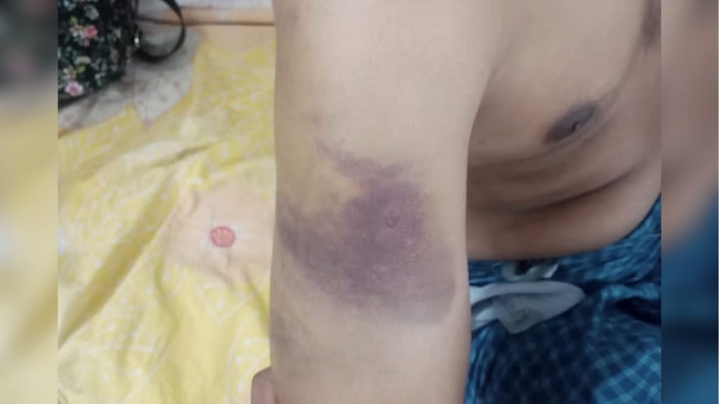 গাইবান্ধায় নিরাময়কেন্দ্রে যুবককে অমানবিক নির্যাতন থানায় অভিযোগ গাইবান্ধায় নিরাময়কেন্দ্রে যুবককে অমানবিক নির্যাতন, থানায় অভিযোগ