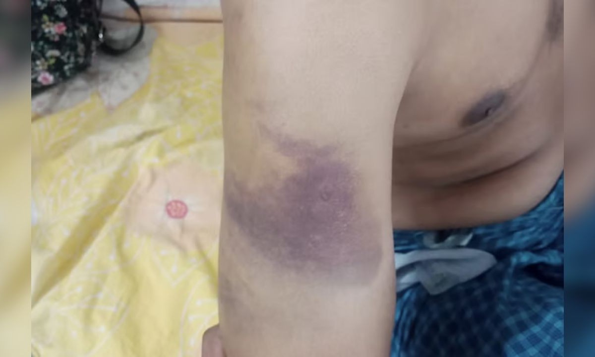 গাইবান্ধায় নিরাময়কেন্দ্রে যুবককে অমানবিক নির্যাতন, থানায় অভিযোগ