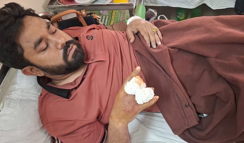 রাজশাহী-৫ নির্বাচনী সহিংসতায় ‘বিদ্রোহী’ সমর্থক আহত