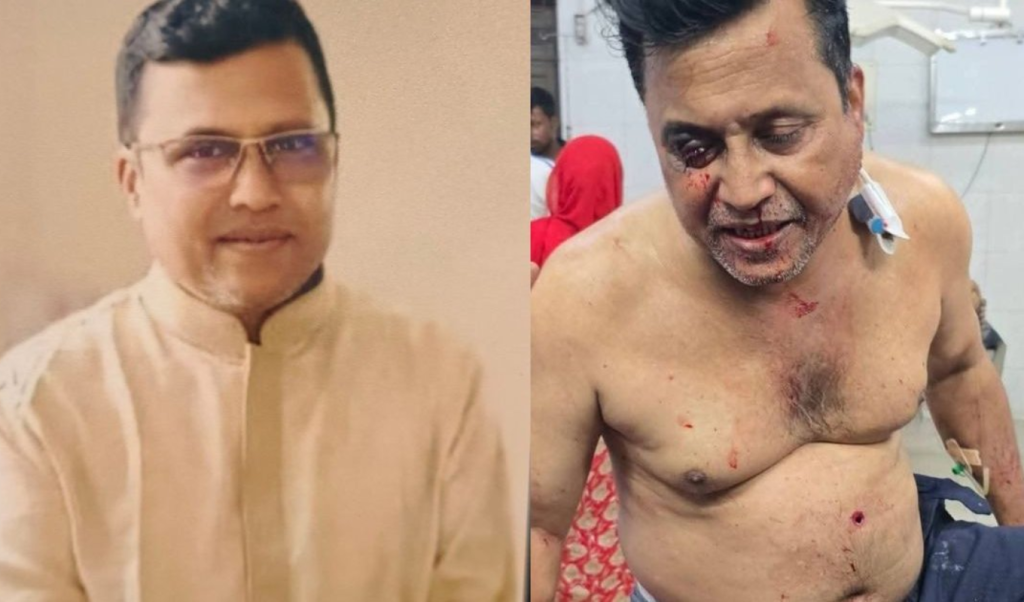 কুষ্টিয়ায় আওয়ামী লীগ নেতাকে গুলি কুষ্টিয়ায় আওয়ামী লীগ নেতাকে গুলি