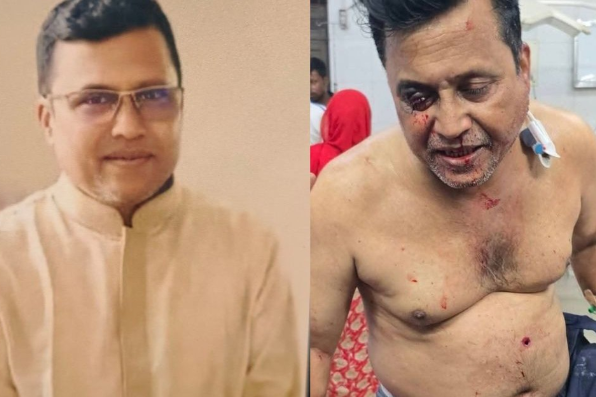 কুষ্টিয়ায় আওয়ামী লীগ নেতাকে গুলি