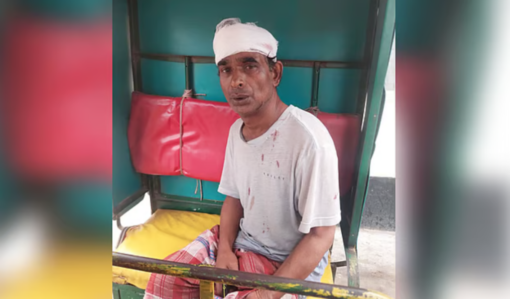 ফতুল্লায় মাদক ব্যবসার প্রতিবাদে ব্যক্তিকে কুপিয়ে জখম ফতুল্লায় মাদক ব্যবসার প্রতিবাদে ব্যক্তিকে কুপিয়ে জখম