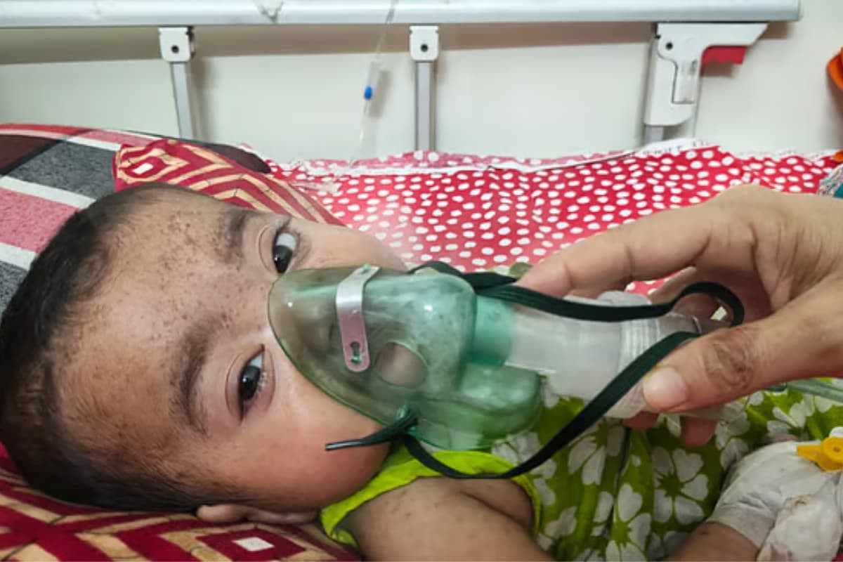 ময়মনসিংহ মেডিকেলে হামের উপসর্গে ছয় ঘণ্টায় তিন শিশুর মৃত্যু