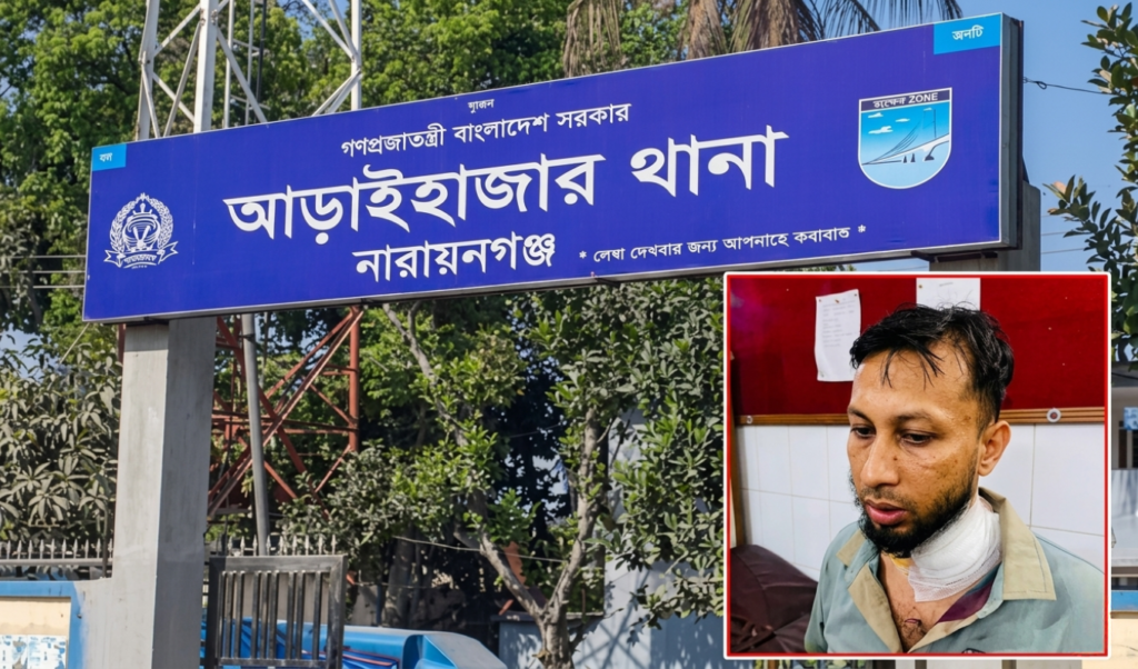 আড়াহাজারে ডাকাত দলের হামলায় এসিল্যান্ডসহ ছয়জন আহত 1 আড়াহাজারে ডাকাত দলের হামলায় এসিল্যান্ডসহ ছয়জন আহত