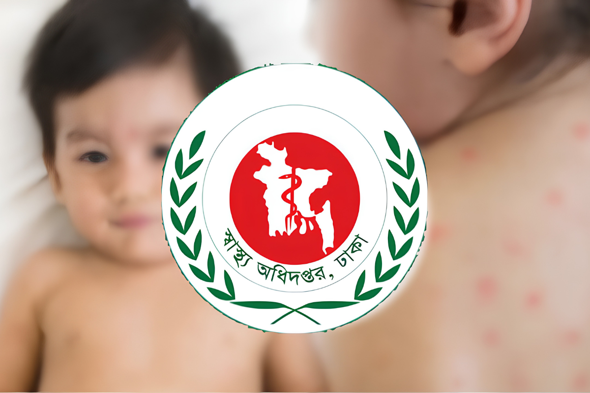 হাম ও উপসর্গে দেশে আরও নয় শিশুর প্রাণহানি, আক্রান্ত ৯৪৫