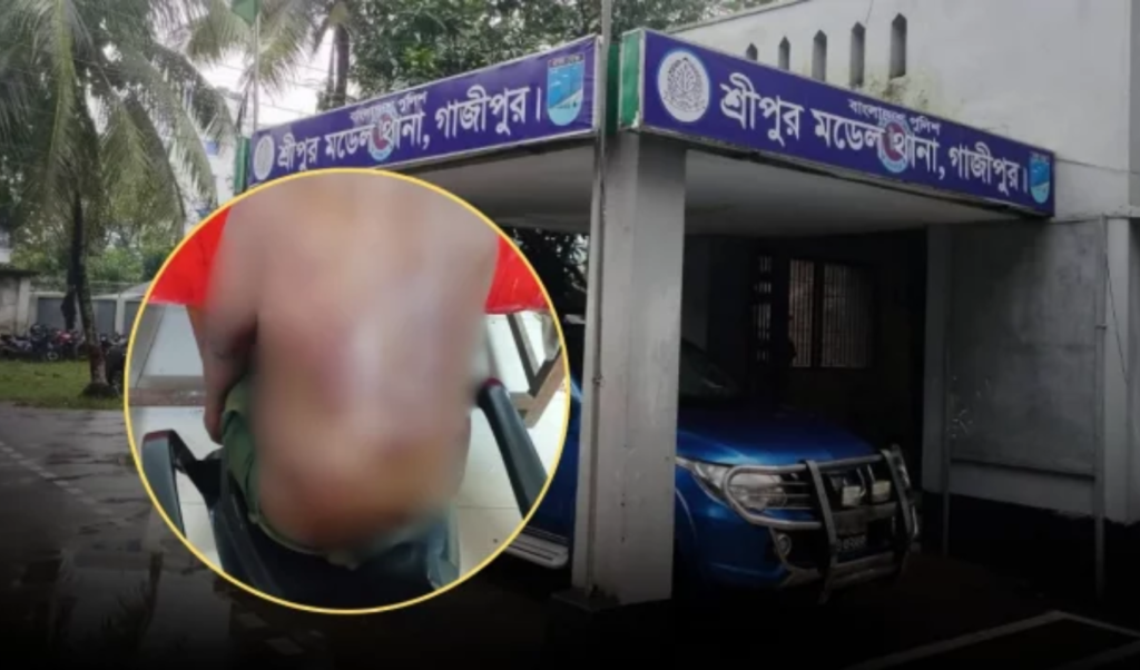 গাজীপুরে চাঁদা না পেয়ে ব্যবসায়ীকে মধ্যযুগীয় নির্যাতন পুলিশ হেফাজতে চিকিৎসাধীন গাজীপুরে চাঁদা না পেয়ে ব্যবসায়ীকে মধ্যযুগীয় নির্যাতন, পুলিশ হেফাজতে চিকিৎসাধীন