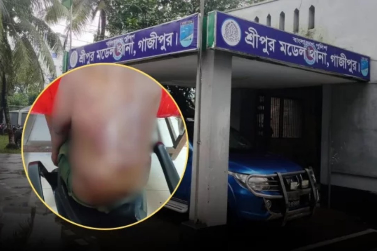 গাজীপুরে চাঁদা না পেয়ে ব্যবসায়ীকে মধ্যযুগীয় নির্যাতন, পুলিশ হেফাজতে চিকিৎসাধীন