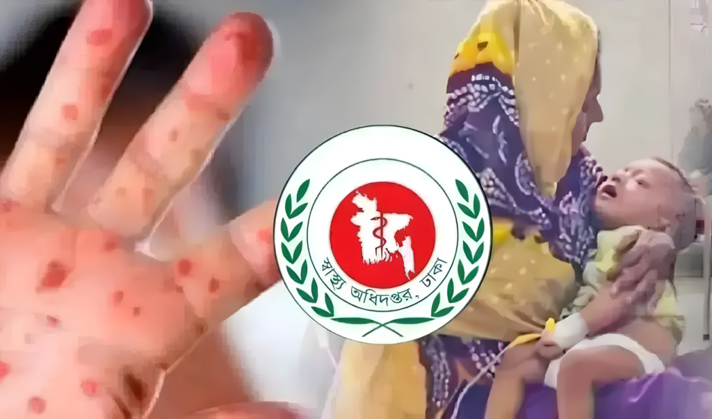 দেশে হামে একদিনে ৭ জনের প্রাণহানি নতুন শনাক্ত ১২২ দেশে হামে একদিনে ৭ জনের প্রাণহানি, নতুন শনাক্ত ১২২