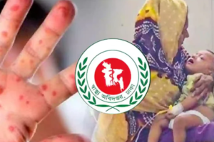 দেশে ২৪ ঘণ্টায় হামের উপসর্গে আরও ৫ শিশুর মৃত্যু