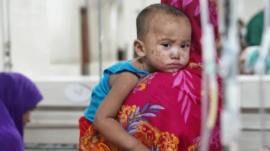 সারাদেশে হামের বিস্তার সন্দেহভাজন আরও তিনজনের মৃত্যু সারাদেশে হামের বিস্তার, সন্দেহভাজন আরও তিনজনের মৃত্যু