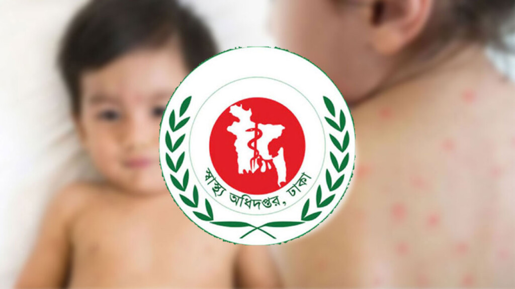 হামে মৃত্যু বেড়ে ৭৯৩ হাসপাতালে আরও ১০৬৯ শিশু হামে মৃত্যু বেড়ে ৭৯৩, হাসপাতালে আরও ১,০৬৯ শিশু