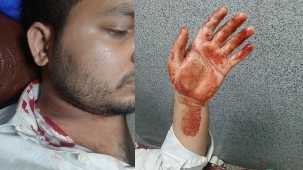 ঢাকা কলেজে ছাত্রদল ছাত্রশিবিরের ধাওয়া পাল্টা ধাওয়া আহত কয়েকজন ঢাকা কলেজে ছাত্রদল-ছাত্রশিবিরের ধাওয়া-পাল্টা ধাওয়া, আহত কয়েকজন
