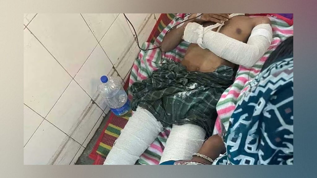 মানিকগঞ্জে ছাত্রলীগ নেতার হাত-পায়ের রগ কাটার অভিযোগ 3 মানিকগঞ্জে ছাত্রলীগ নেতার হাত-পায়ের রগ কাটার অভিযোগ