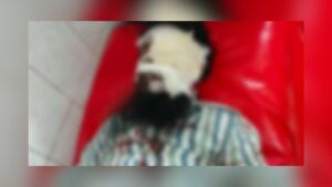 চার্জে থাকা মোবাইল বিস্ফোরণে গুরুতর আহত দুই যুবক