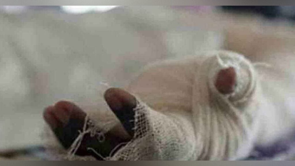বনানীতে গ্যাসের চুলা জ্বালাতে গিয়ে দগ্ধ ফিলিপাইনি পর্যটক 3 বনানীতে গ্যাসের চুলা জ্বালাতে গিয়ে দগ্ধ ফিলিপাইনি পর্যটক