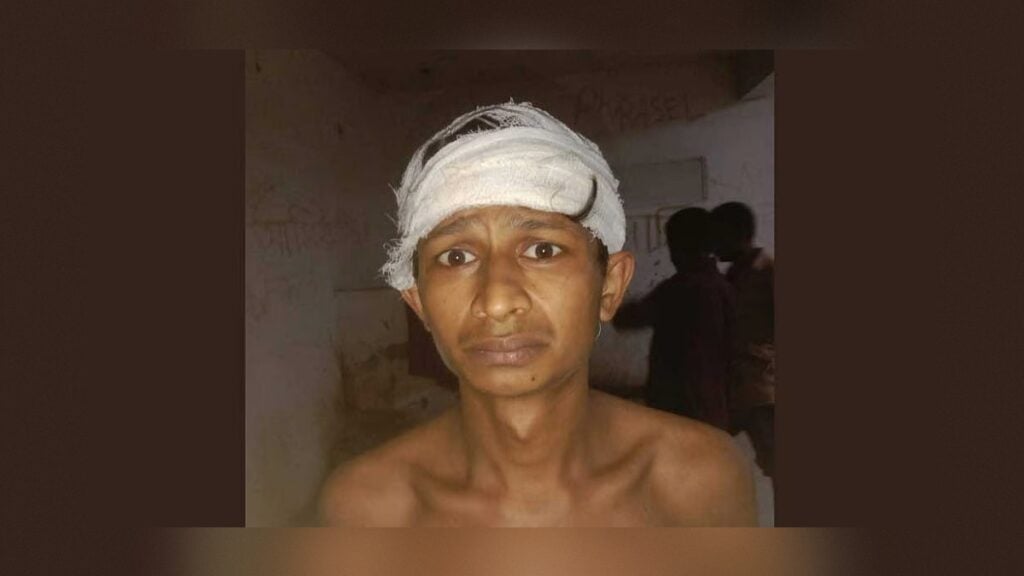 মোহাম্মদপুরে মাদকবিরোধী অভিযানে আহত যুবক 3 মোহাম্মদপুরে মাদকবিরোধী অভিযানে আহত যুবক